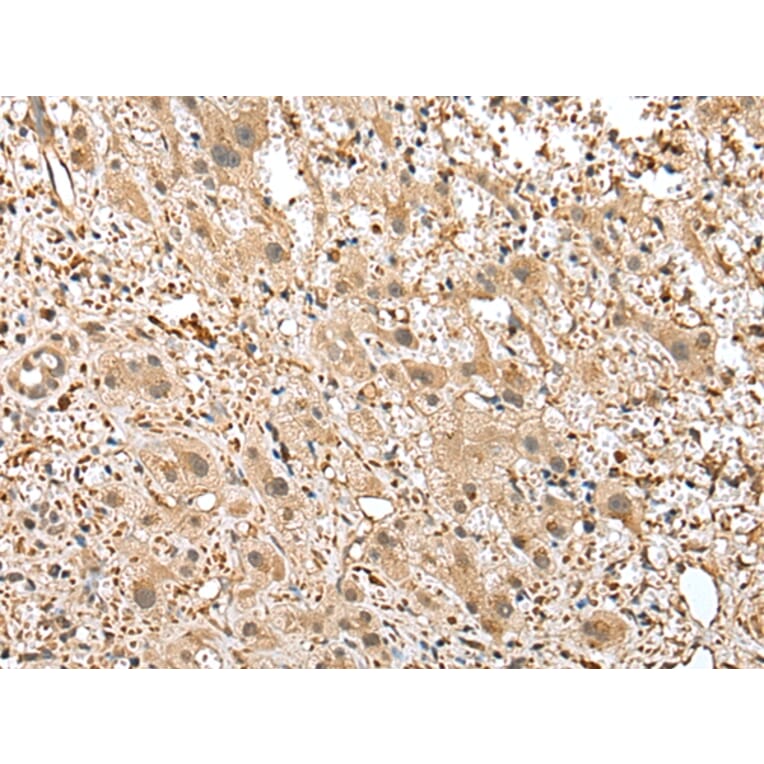 Immunohistochemistry - GSTM2 Antibody from Signalway Antibody (43377) - Antibodies.com