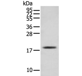 TNNC1 Antibody from Signalway Antibody (43381) - Antibodies.com