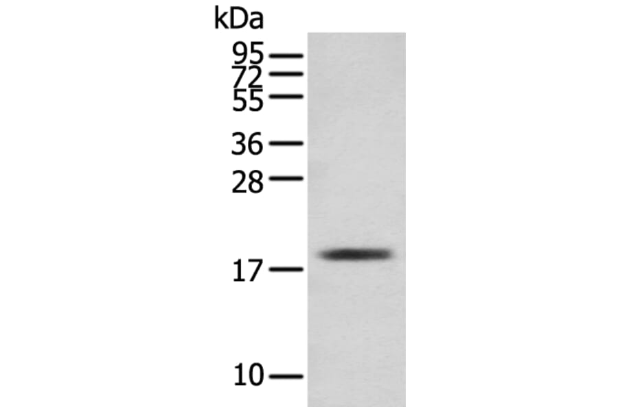 TNNC1 Antibody from Signalway Antibody (43381) - Antibodies.com