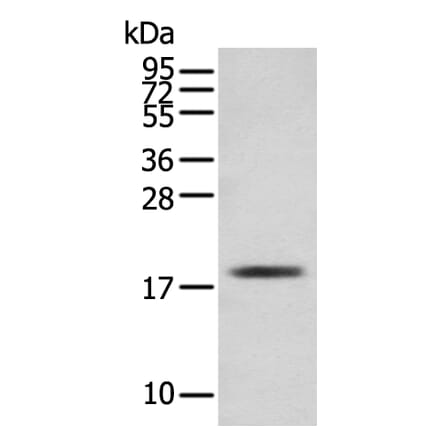 TNNC1 Antibody from Signalway Antibody (43381) - Antibodies.com