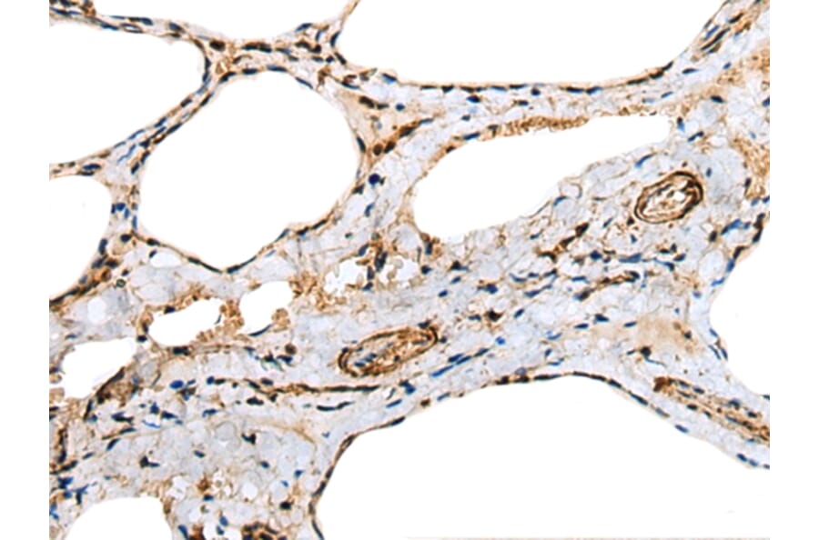 Immunohistochemistry - TNNC1 Antibody from Signalway Antibody (43381) - Antibodies.com