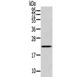 RAB17 Antibody from Signalway Antibody (43393) - Antibodies.com