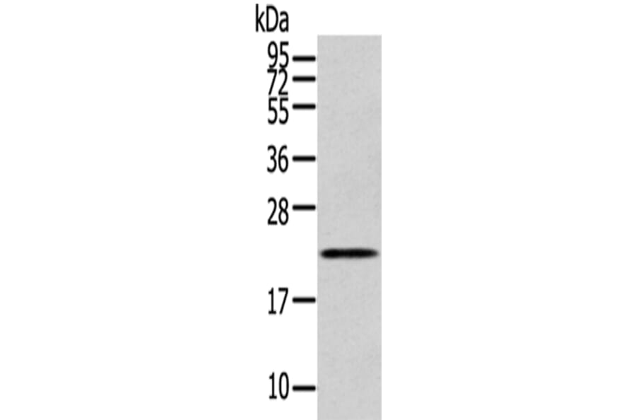 RAB17 Antibody from Signalway Antibody (43393) - Antibodies.com