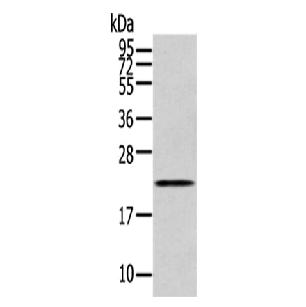 RAB17 Antibody from Signalway Antibody (43393) - Antibodies.com