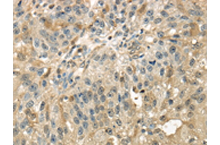 Immunohistochemistry - RAB17 Antibody from Signalway Antibody (43393) - Antibodies.com