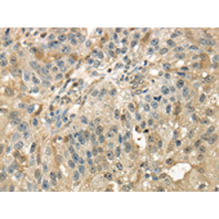 Immunohistochemistry - RAB17 Antibody from Signalway Antibody (43393) - Antibodies.com