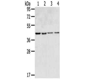 GPR15 Antibody from Signalway Antibody (43419) - Antibodies.com