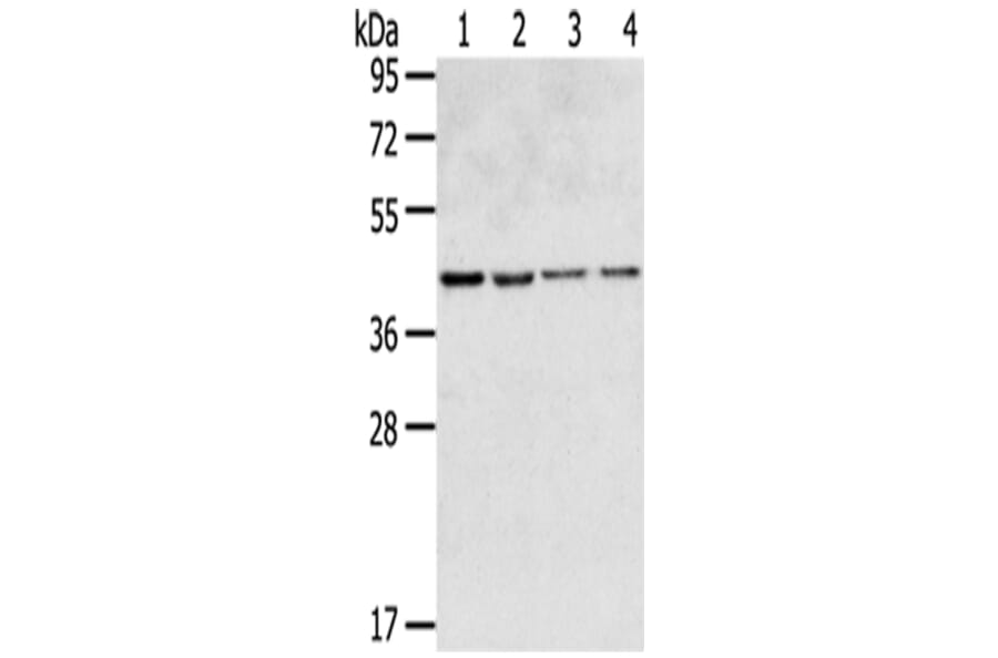 GPR15 Antibody from Signalway Antibody (43419) - Antibodies.com