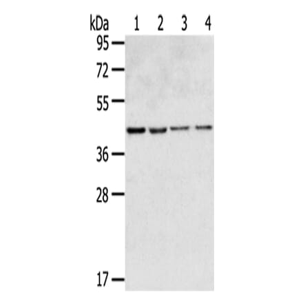 GPR15 Antibody from Signalway Antibody (43419) - Antibodies.com