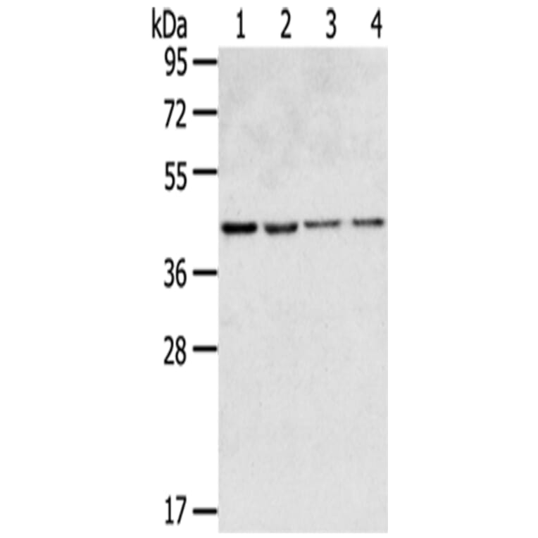 GPR15 Antibody from Signalway Antibody (43419) - Antibodies.com