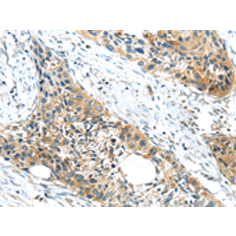 Immunohistochemistry - GPR15 Antibody from Signalway Antibody (43419) - Antibodies.com