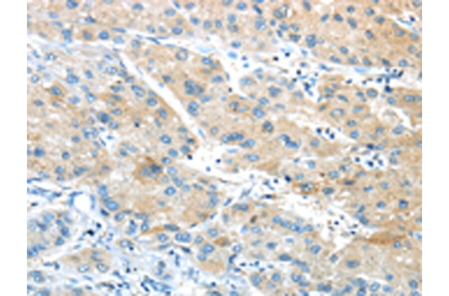 Immunohistochemistry - GPR15 Antibody from Signalway Antibody (43419) - Antibodies.com