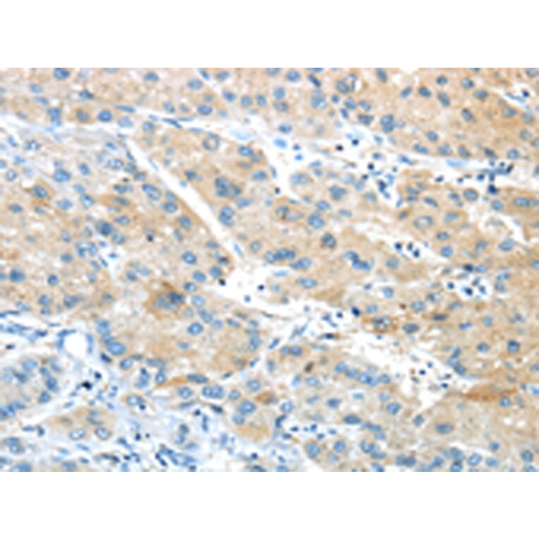Immunohistochemistry - GPR15 Antibody from Signalway Antibody (43419) - Antibodies.com