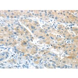 Immunohistochemistry - GPR15 Antibody from Signalway Antibody (43419) - Antibodies.com