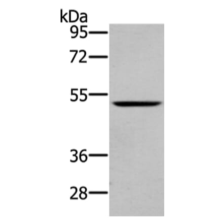 WASF2 Antibody from Signalway Antibody (43432) - Antibodies.com