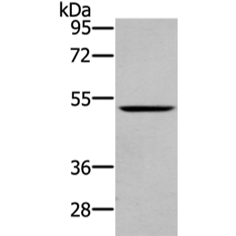 WASF2 Antibody from Signalway Antibody (43432) - Antibodies.com