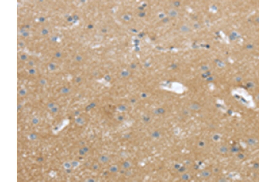 Immunohistochemistry - WASF2 Antibody from Signalway Antibody (43432) - Antibodies.com