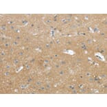 Immunohistochemistry - WASF2 Antibody from Signalway Antibody (43432) - Antibodies.com