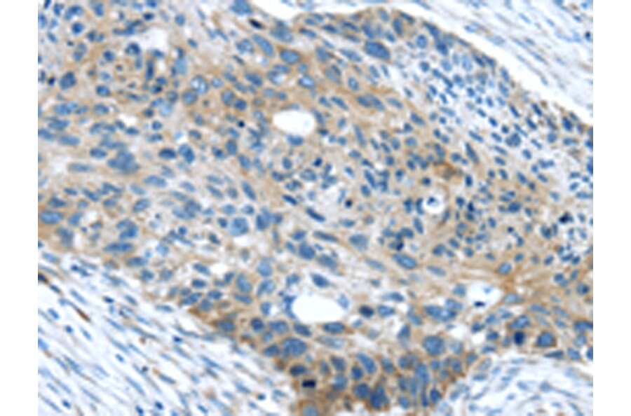 Immunohistochemistry - WASF2 Antibody from Signalway Antibody (43432) - Antibodies.com