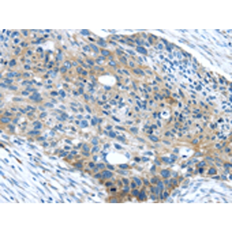 Immunohistochemistry - WASF2 Antibody from Signalway Antibody (43432) - Antibodies.com