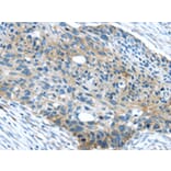 Immunohistochemistry - WASF2 Antibody from Signalway Antibody (43432) - Antibodies.com