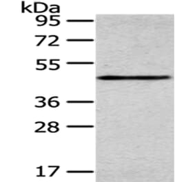 SMYD2 Antibody from Signalway Antibody (43434) - Antibodies.com