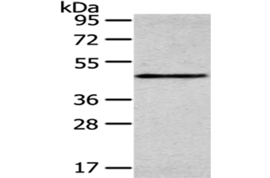 SMYD2 Antibody from Signalway Antibody (43434) - Antibodies.com
