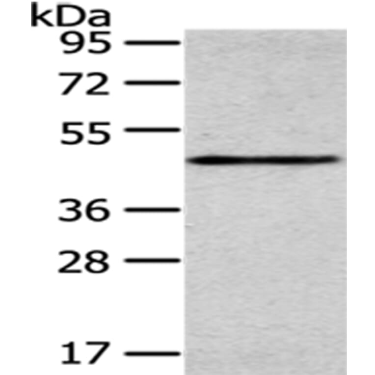 SMYD2 Antibody from Signalway Antibody (43434) - Antibodies.com