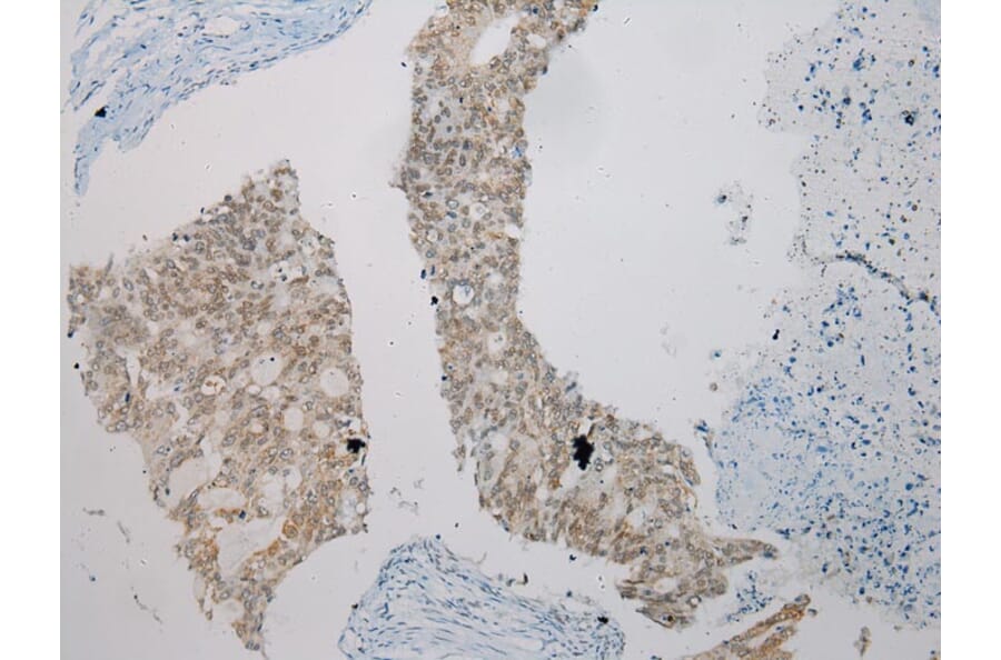 Immunohistochemistry - SMYD2 Antibody from Signalway Antibody (43434) - Antibodies.com