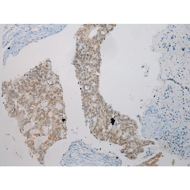Immunohistochemistry - SMYD2 Antibody from Signalway Antibody (43434) - Antibodies.com