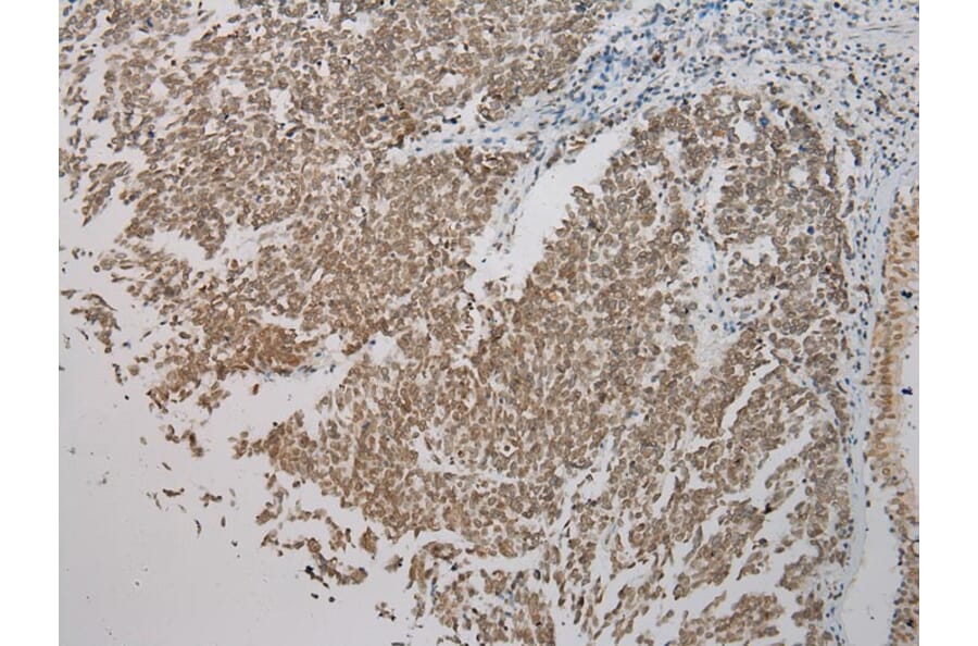 Immunohistochemistry - SMYD2 Antibody from Signalway Antibody (43434) - Antibodies.com