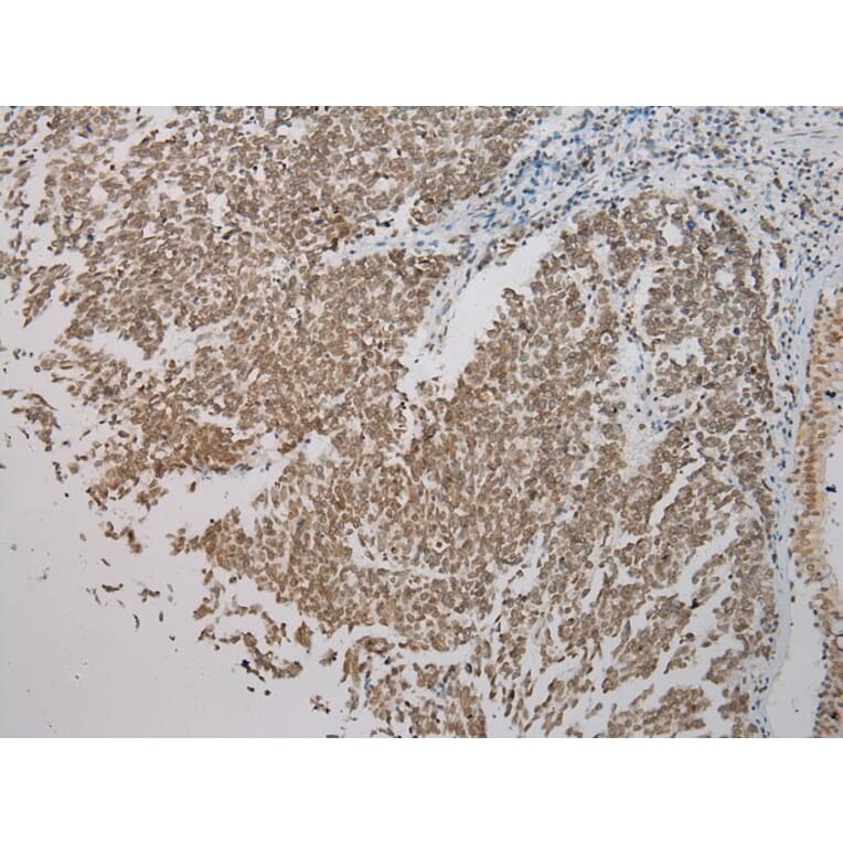 Immunohistochemistry - SMYD2 Antibody from Signalway Antibody (43434) - Antibodies.com