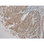 Immunohistochemistry - SMYD2 Antibody from Signalway Antibody (43434) - Antibodies.com