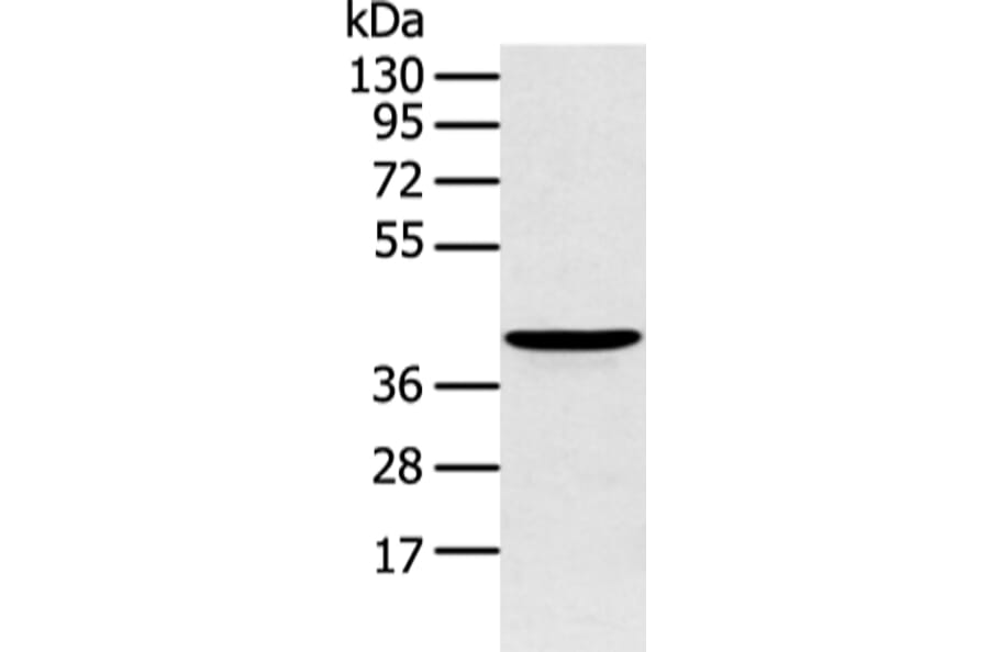 ADRB2 Antibody from Signalway Antibody (43453) - Antibodies.com