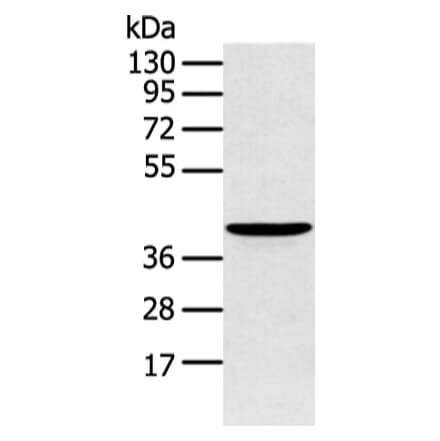 ADRB2 Antibody from Signalway Antibody (43453) - Antibodies.com