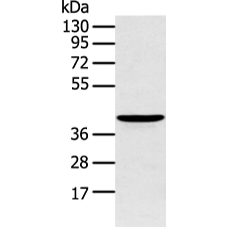 ADRB2 Antibody from Signalway Antibody (43453) - Antibodies.com