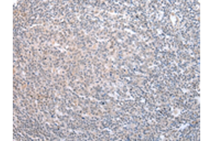 Immunohistochemistry - ADRB2 Antibody from Signalway Antibody (43453) - Antibodies.com