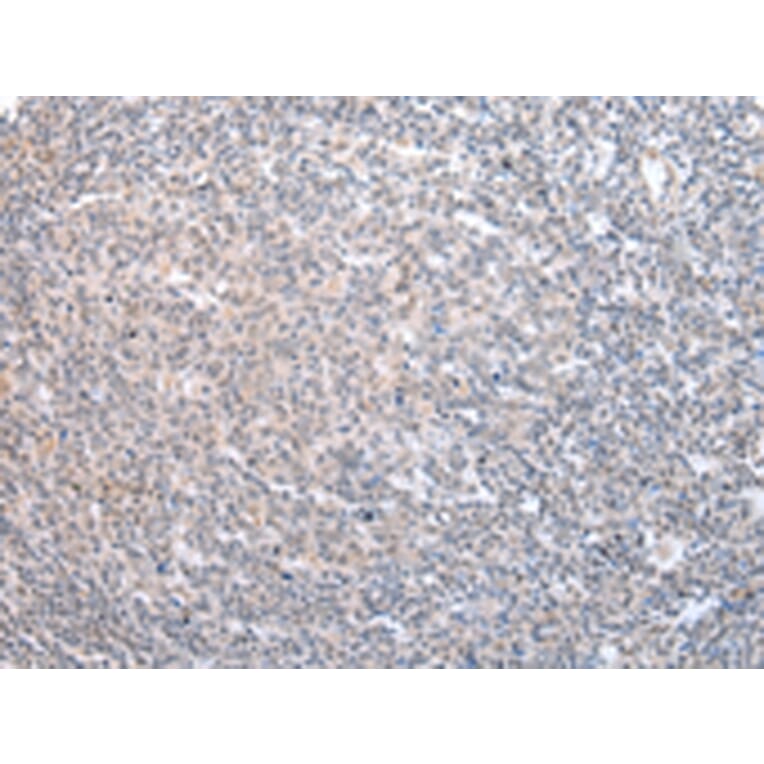 Immunohistochemistry - ADRB2 Antibody from Signalway Antibody (43453) - Antibodies.com