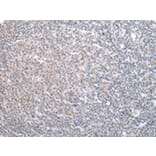 Immunohistochemistry - ADRB2 Antibody from Signalway Antibody (43453) - Antibodies.com