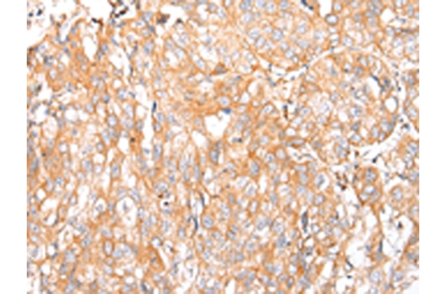 Immunohistochemistry - HTR2A Antibody from Signalway Antibody (43462) - Antibodies.com