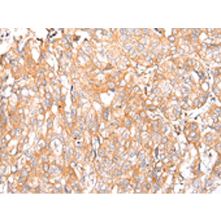 Immunohistochemistry - HTR2A Antibody from Signalway Antibody (43462) - Antibodies.com