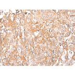 Immunohistochemistry - HTR2A Antibody from Signalway Antibody (43462) - Antibodies.com