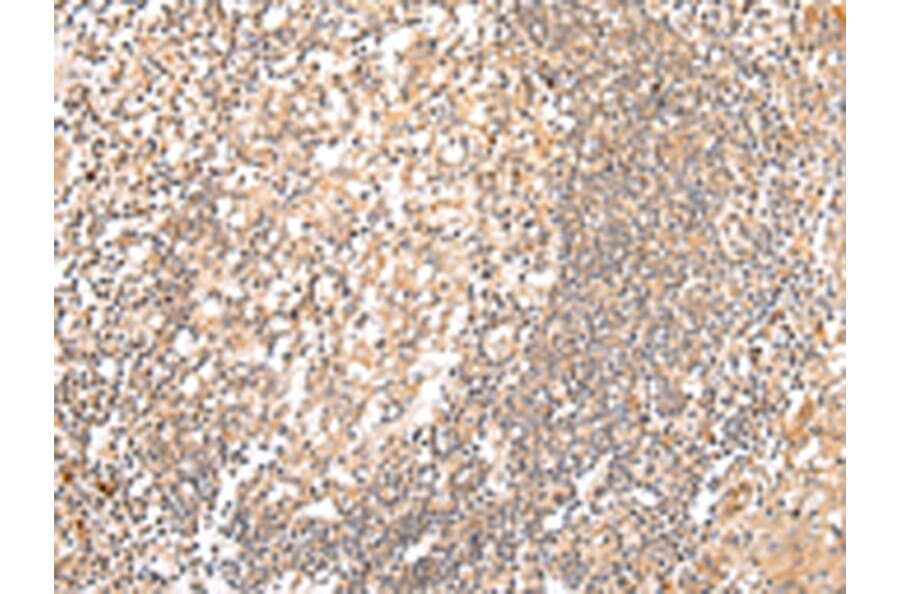 Immunohistochemistry - HTR2A Antibody from Signalway Antibody (43462) - Antibodies.com