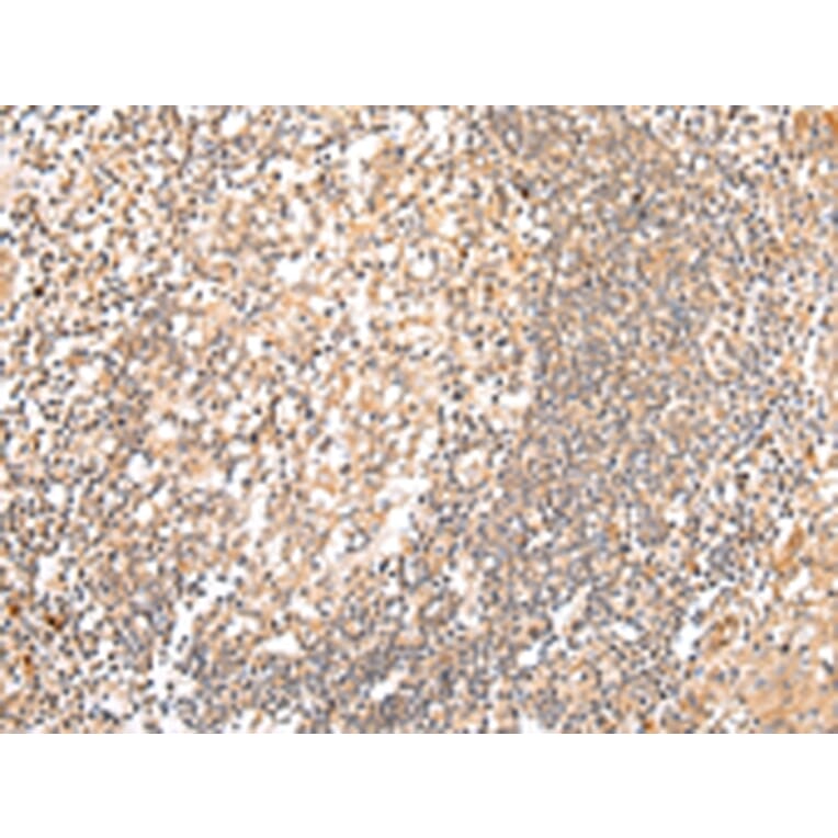 Immunohistochemistry - HTR2A Antibody from Signalway Antibody (43462) - Antibodies.com