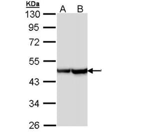 Alpha Smooth Muscle Actin antibody from Signalway Antibody (22956) - Antibodies.com