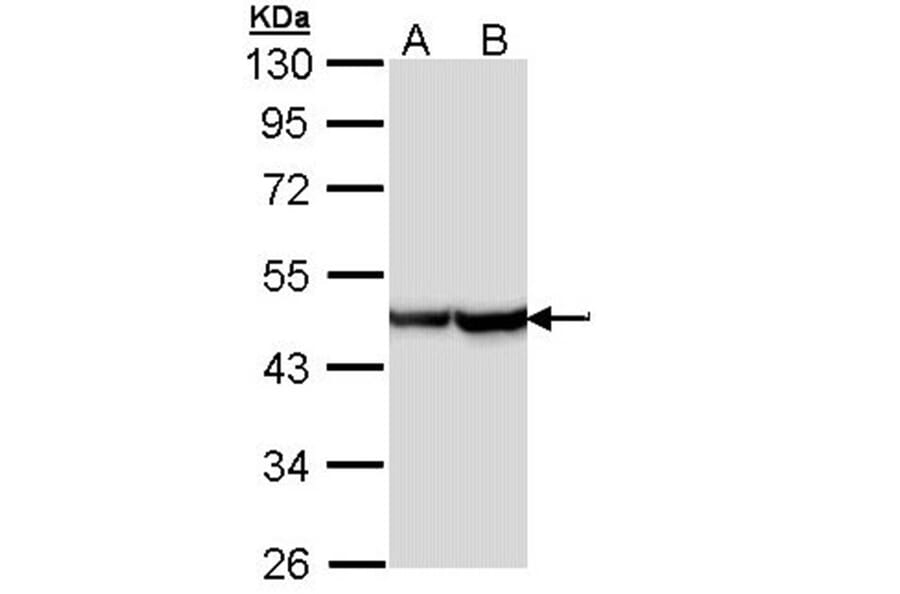 Alpha Smooth Muscle Actin antibody from Signalway Antibody (22956) - Antibodies.com
