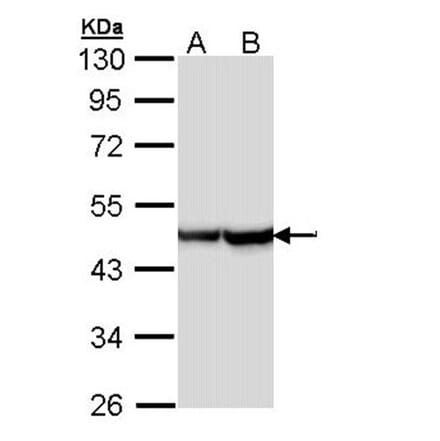 Alpha Smooth Muscle Actin antibody from Signalway Antibody (22956) - Antibodies.com