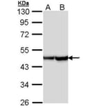 Alpha Smooth Muscle Actin antibody from Signalway Antibody (22956) - Antibodies.com