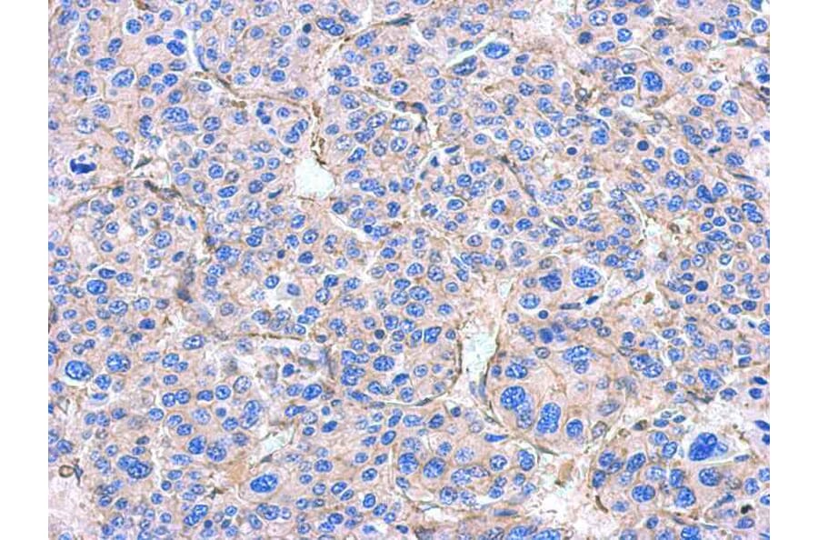 Immunohistochemistry - Alpha Smooth Muscle Actin antibody from Signalway Antibody (22956) - Antibodies.com