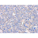 Immunohistochemistry - Alpha Smooth Muscle Actin antibody from Signalway Antibody (22956) - Antibodies.com